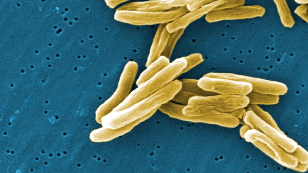 Colourised electron micrograph of Mycobacterium tuberculosis bacteria, the organism that causes TB